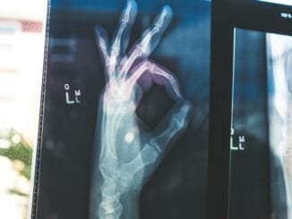 Google's open MedGemma AI models could transform healthcare