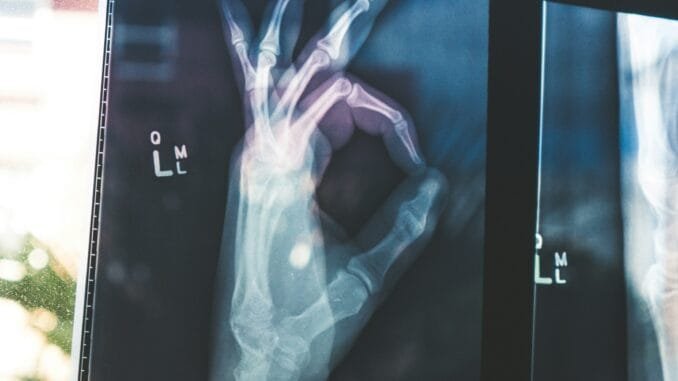 Google's open MedGemma AI models could transform healthcare Google's open MedGemma AI models could transform healthcare